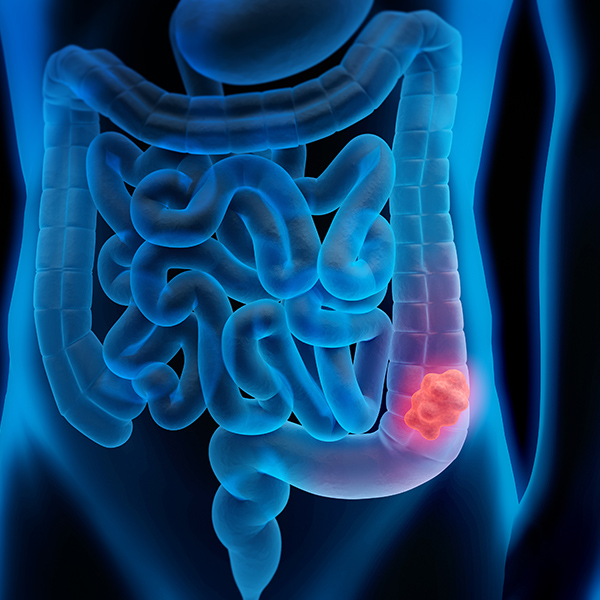 中野坂上米沢医院のAI（人工知能）を活用した高精度な内視鏡検査